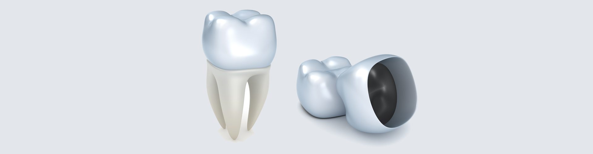Dental Crowns: When and Why You Need Them?