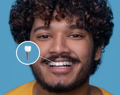 Dental Implants After Tooth Loss: Why Early Replacement Matters