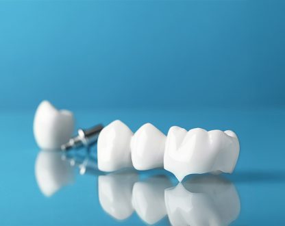 How Dental Crowns Help Restore Teeth After Large Fillings Fail