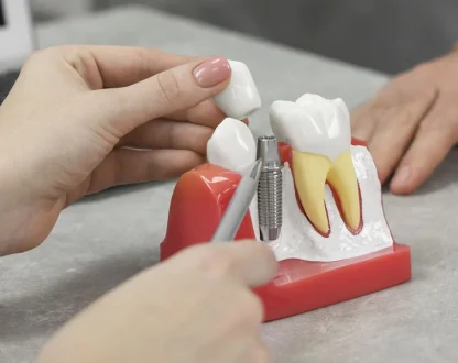 How Dental Implants Help Maintain Bite Alignment After Losing a Tooth